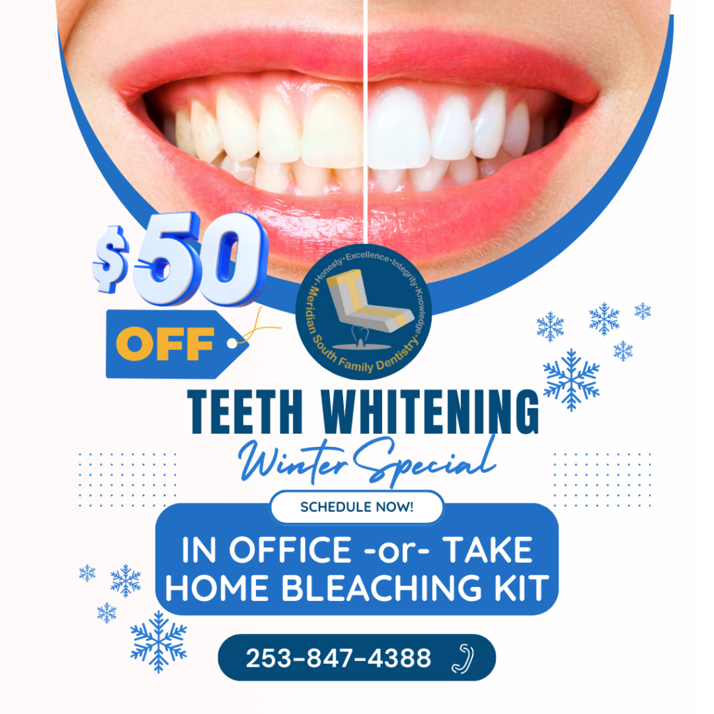 Transform Your Smile with Professional Teeth Whitening