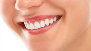 Why Choose Meridian South Family Dentistry for Your Dental Crown Needs?