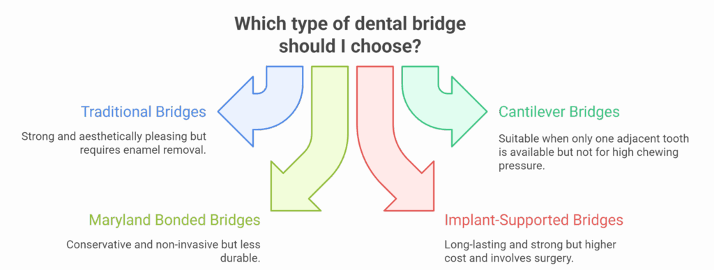Types of Dental Bridges