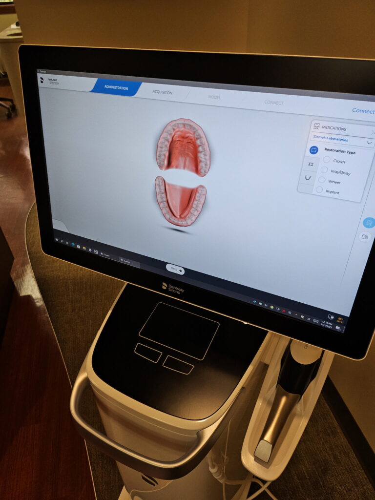 Dental crown being fitted onto a tooth.