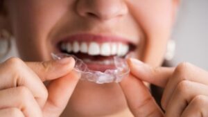 7 Smart Ways to Protect Your Smile During Sports and Activities