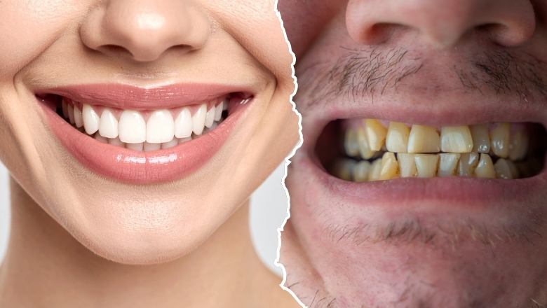Healthy Teeth vs Unhealthy Teeth: What Most People Miss