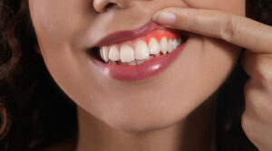 Early Signs of Gum Disease You Should Never Ignore