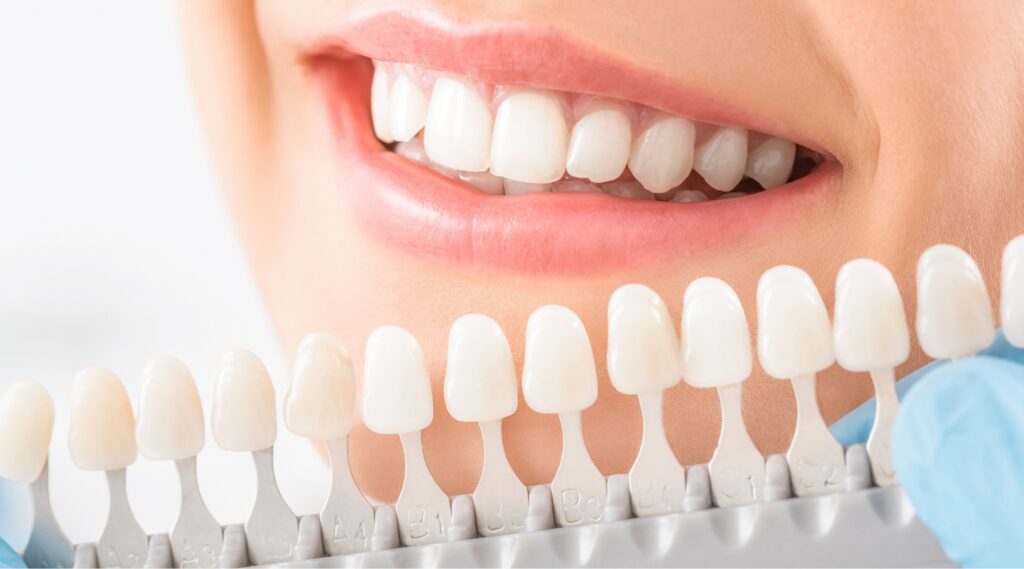 Dental Crown Care Tips for a Long-Lasting Smile