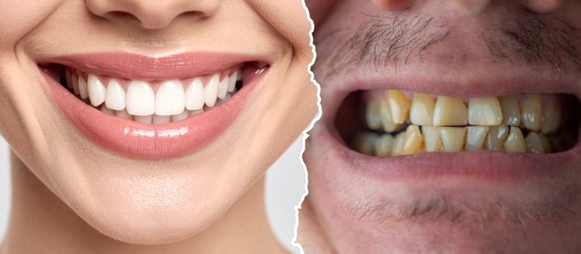Healthy Teeth vs Unhealthy Teeth: What Most People Miss