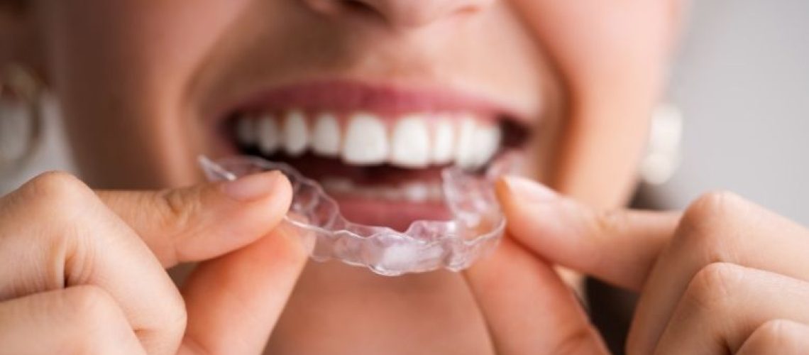 7 Smart Ways to Protect Your Smile During Sports and Activities