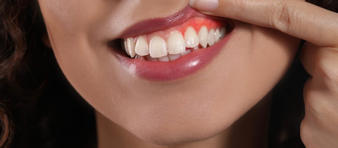 Early Signs of Gum Disease You Should Never Ignore