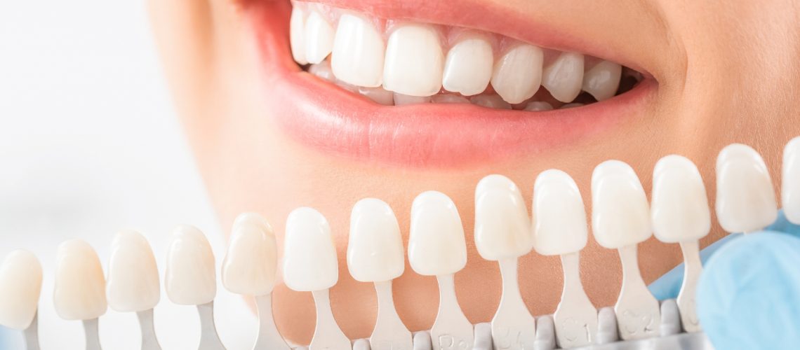 Dental Crown Care Tips for a Long-Lasting Smile